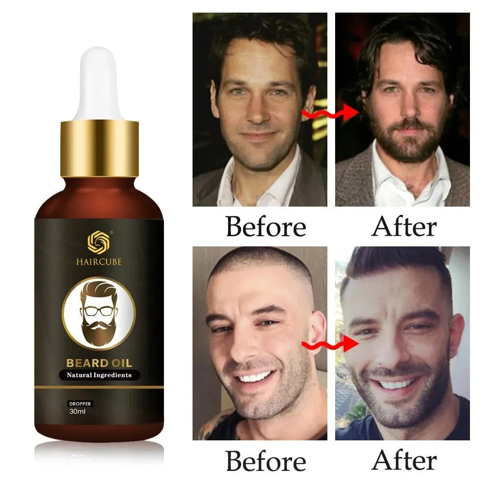 Growth Essential Oil Natural Beard Growth - Bellarte Enchanté Growth Essential Oil Natural Beard Growth